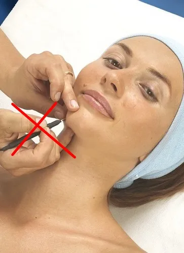 Фотоепіляція підготовка до процедури