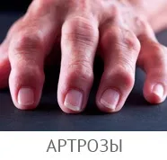 Болі в паху при остеохондрозі, чи може віддавати в промежину (болі) Болі в паху при остеохондрозі, чи може віддавати в промежину