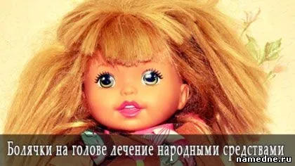 Болячки на голові лікування народними засобами - шкірні захворювання - лікування хвороб - народні (болячки) Болячки на голові лікування народними засобами - шкірні захворювання - лікування хвороб - народні