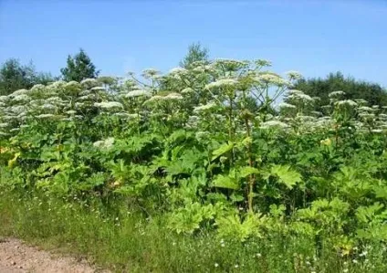 Чим лікувати опік від борщівника і перша допомога (опік) Чим лікувати опік від борщівника і перша допомога