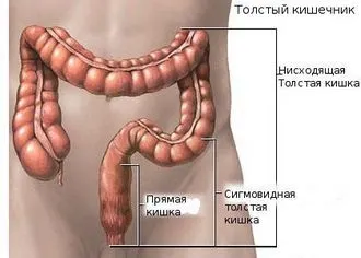Чим зняти запалення кишечника - модна красива (кишечника) Чим зняти запалення кишечника - модна красива