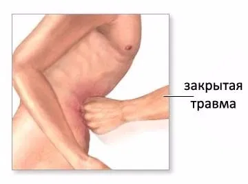 Що буде якщо вагітну вдарити в животі (вдарити) Що буде якщо вагітну вдарити в животі