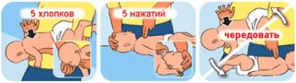 Що робити якщо дитина подавився перша допомога