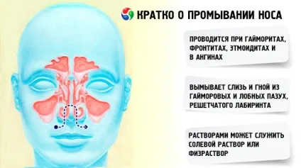 Що робити, якщо болять пазухи носа - кращі методи лікування (робити) Що робити, якщо болять пазухи носа - кращі методи лікування