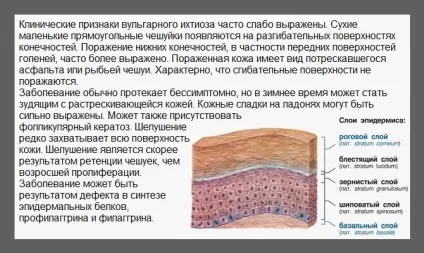 Луска на шкірі