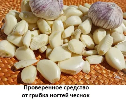 Часник від грибка нігтів на ногах - рецепт народного кошти з маслом, сайт про методи лікування (рецепти приготування трав) Часник від грибка нігтів на ногах - рецепт народного кошти з маслом, сайт про методи лікування