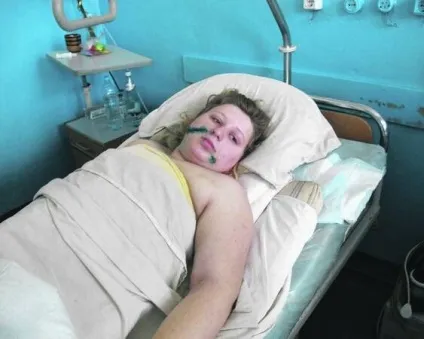 Що буде якщо вагітну вдарити в животі (вдарити) Що буде якщо вагітну вдарити в животі
