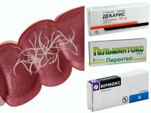 Що краще декаріс або пирантел, вермокс, Немозол