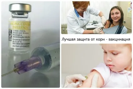 Що таке кір зараження, лікування, наслідки відео (лікування) Що таке кір зараження, лікування, наслідки відео