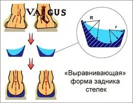 Дітям, ортекс - ортопедичний салон