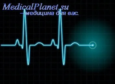 Деполяризація шлуночків (деполяризація) деполяризація шлуночків