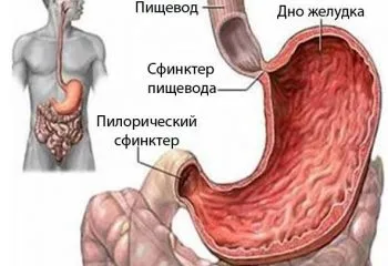 Дісгермінома яєчника симптоми і методи терапії