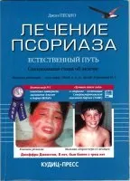 Джон Пегано - лікування псоріазу - природний шлях (лікування) Джон Пегано - лікування псоріазу - природний шлях