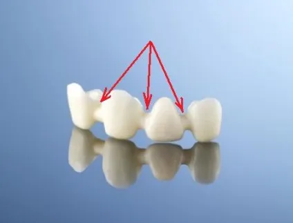 Галітоз, або чому з рота неприємно пахне, perfectsmile (запах з рота) Галітоз, або чому з рота неприємно пахне, perfectsmile
