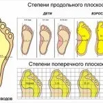 Гелеві нігті в домашніх умовах (краса) Гелеві нігті в домашніх умовах