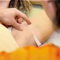 Гіпергідроз причини, лікування