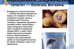 Гепатит у новонароджених симптоми і лікування вродженої форми (симптоми) Гепатит у новонароджених симптоми і лікування вродженої форми