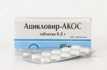 Герпес на голові як лікувати (голові) Герпес на голові як лікувати