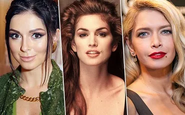Родзинка або недолік найзнаменитіші родимки зірок, журнал cosmopolitan (віра Брежнєва) Родзинка або недолік найзнаменитіші родимки зірок, журнал cosmopolitan