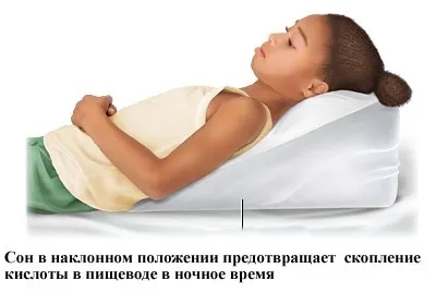Печія у дитини причини, як позбутися, що можна (виявити причини появи) Печія у дитини причини, як позбутися, що можна