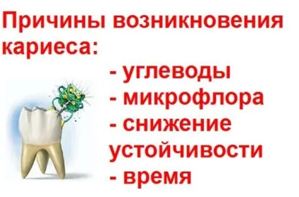 Через що з'являється карієс - розвиток карієсу і його причини