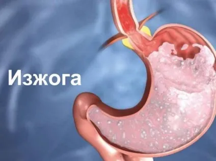 Печія у дитини причини і лікування симптомів (дитини) Печія у дитини причини і лікування симптомів