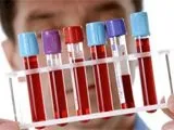 Як відвикнути від крапель для носа, корисні поради, модні поради - жіночий онлайн журнал (відвикнути) Як відвикнути від крапель для носа, корисні поради, модні поради - жіночий онлайн журнал