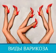 Як проявляється клапаннанедостатність вен (клапанна) Як проявляється клапаннанедостатність вен