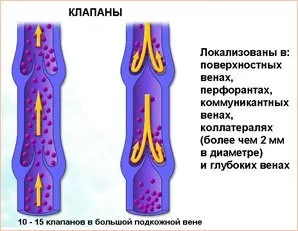 Як проявляється клапаннанедостатність вен (недостатність) Як проявляється клапаннанедостатність вен