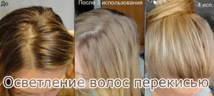 Як зробити волосся білими поради та рекомендації (волосся) Як зробити волосся білими поради та рекомендації