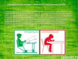 Як виправити поставу дорослій людині методи, виправлення будинку (виправити) Як виправити поставу дорослій людині методи, виправлення будинку