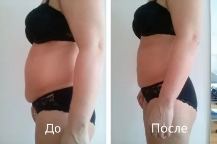 Кавітація для схуднення ціна, відгуки, відео (схуднення) Кавітація для схуднення ціна, відгуки, відео