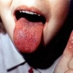Коли дитині починати чистити зуби (зуби) Коли дитині починати чистити зуби
