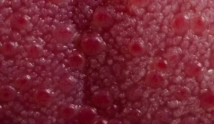 Коли дитині починати чистити зуби (після нічного годування) Коли дитині починати чистити зуби