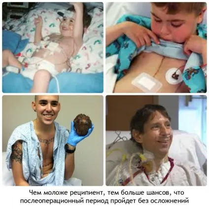 Коли треба робити пересадку серця, фактори ризику і виживання після операції, відео (серця) Коли треба робити пересадку серця, фактори ризику і виживання після операції, відео