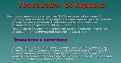 Ком і біль в горлі при щитовидній залозі симптоми (залозі) Ком і біль в горлі при щитовидній залозі симптоми