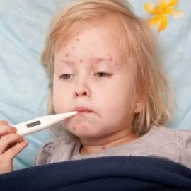 Кір фото симптомів, як передається хвороба, назви вакцин від кору і ускладнення після щеплень (передається) Кір фото симптомів, як передається хвороба, назви вакцин від кору і ускладнення після щеплень