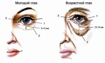 Корекція Носослізний борозни філлерамі (контурна пластика)