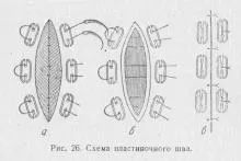 Лікування гранулюючих ран, довідник лікаря (інших частин тіла) Лікування гранулюючих ран, довідник лікаря