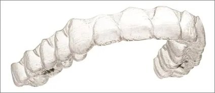 Виправлення прикусу без брекетів за допомогою кап invisalign (кап) Виправлення прикусу без брекетів за допомогою кап invisalign