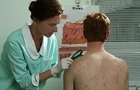 Мокнучі екзема симптоми і лікування (екзема) Мокнучі екзема симптоми і лікування