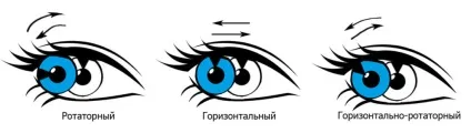 Ністагм очей що це, причини, види, діагностика і лікування (види) Ністагм очей що це, причини, види, діагностика і лікування