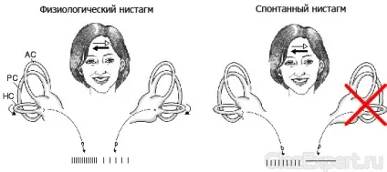 Ністагм очей що це, причини, види, діагностика і лікування (причини) Ністагм очей що це, причини, види, діагностика і лікування
