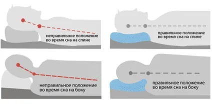 Остеохондроз шийного відділу хребта ознаки, причини, ступеня, наслідки, діагностика і (шийно грудної остеохондроз симптоми) Остеохондроз шийного відділу хребта ознаки, причини, ступеня, наслідки, діагностика та