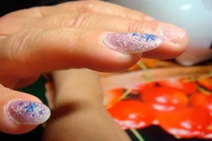 Відшарування при нарощуванні нігтів (нарощування нігтів) Відшарування при нарощуванні нігтів