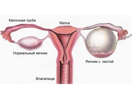 Як роблять узі матки і придатків
