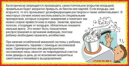 Опік у дитини з пухирями