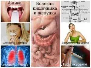 Чому неприємно пахне з рота причини (чому смердить) Чому неприємно пахне з рота причини