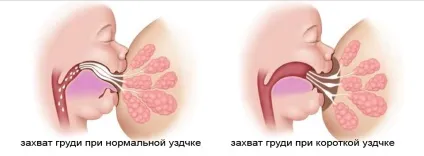 Чому немовля прицмокує при годуванні (годуванні) Чому немовля прицмокує при годуванні