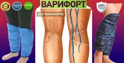 Подушка варіфорт від варикозу міфи і правда (варикозу) Подушка варіфорт від варикозу міфи і правда